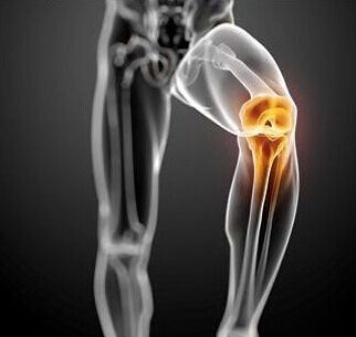 哪个运动对膝盖损伤最大,膝盖运动损伤部位对照表