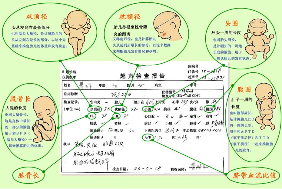 孕妈必备详细清单,孕期35天b超能看出来吗