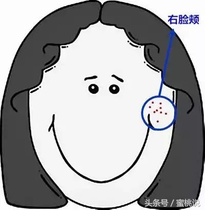 12岁脸上长痘按什么穴位,各个部位长痘原因太阳穴