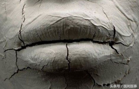 嘴唇一到秋冬就干裂,进入秋冬嘴巴老是干裂