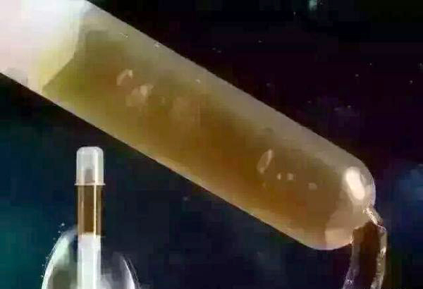 精致美女，肚脐又红又痒，仔细一问，才知道是1种习惯惹的祸