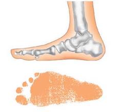 扁平足要穿什么鞋矫正好,扁平足穿什么鞋最舒服