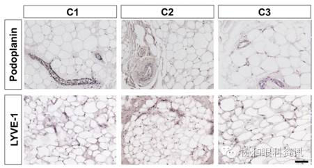 文摘速递TAO眶压升高,谁是幕后元凶?