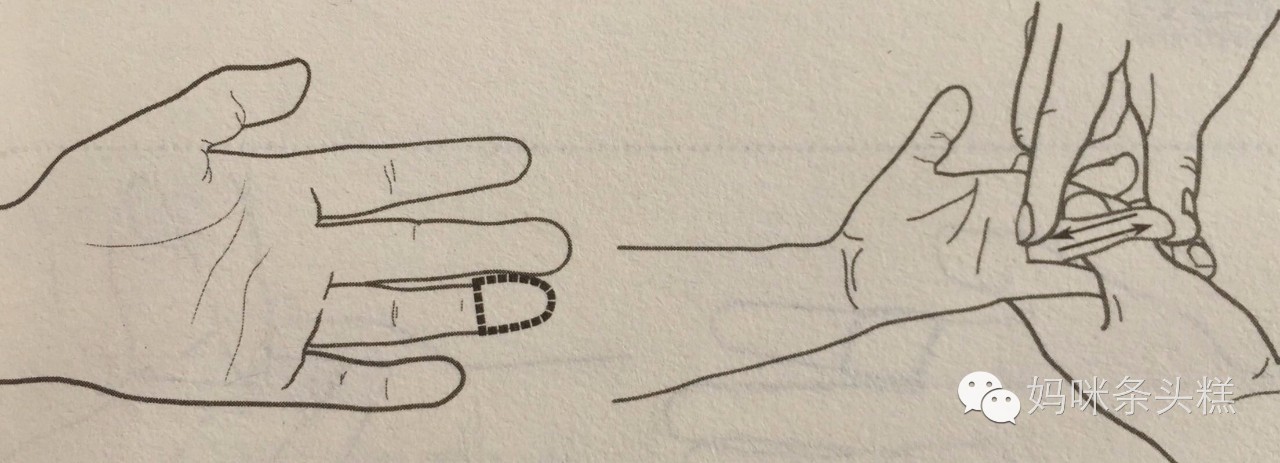 感冒咳嗽多痰流涕,感冒后咳嗽有痰中医怎么治疗