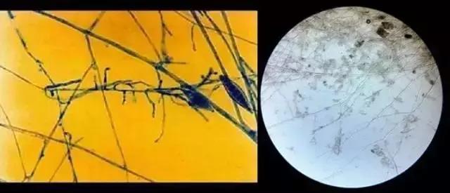 有脚气要分手吗,有脚气要不要分手