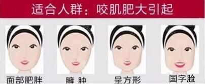 瘦脸针一个月没效果多久才能补打,瘦脸针打完多久能达到最佳效果