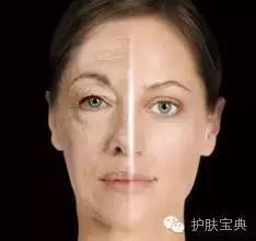 女生会在意男生的抬头纹,有一天突然发现自己有了抬头纹