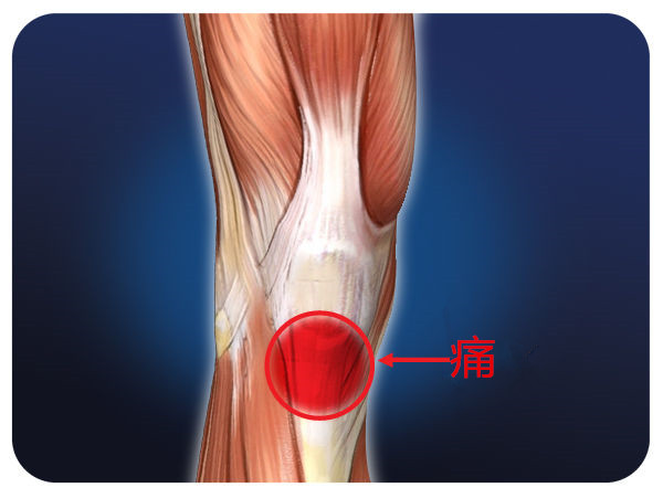 运动后修复膝盖喷雾,膝盖长期运动受损怎么办