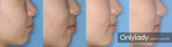 希拉里牙齿怎么样,希拉里的女儿怎么样