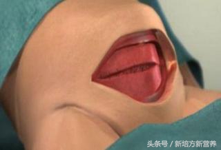 宝宝湿疹用激素药副作用,治疗湿疹的炉甘石有副作用吗