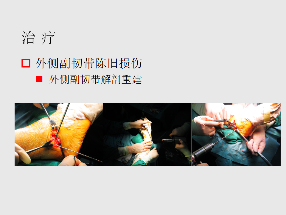 脚崴了怎么办判断是否骨折,脚崴了怎么办视频