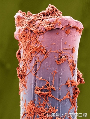 牙医能辨别出换过没换过的牙齿吗,牙医见过最好的牙齿是怎么样的