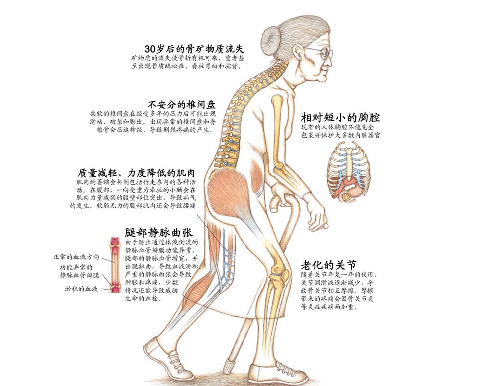 人到中年后骨质疏松要怎么治,中老年人骨质疏松该怎么办