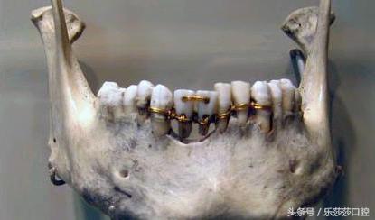 牙医能辨别出换过没换过的牙齿吗,牙医见过最好的牙齿是怎么样的