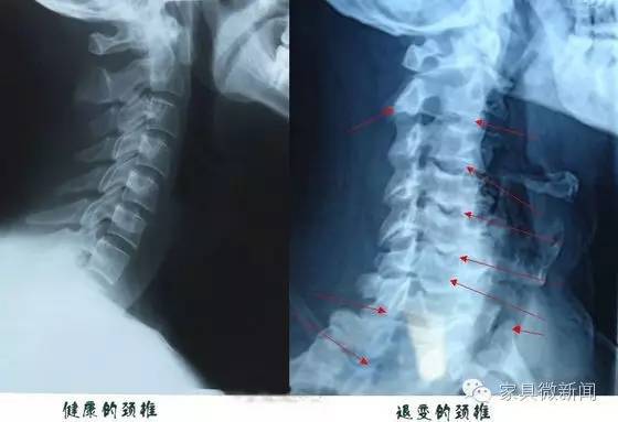 乳胶床垫和枕头对睡眠有好处吗,床垫和枕头哪个更有助于睡眠