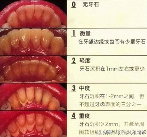 牙医能辨别出换过没换过的牙齿吗,牙医见过最好的牙齿是怎么样的
