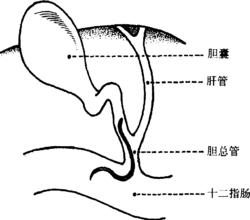男子腹痛难忍医生实施手术,男子长期腹痛检查出虫子