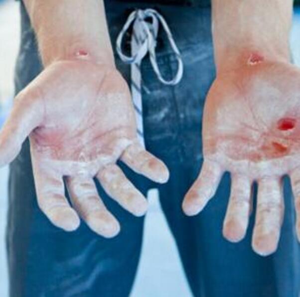 小孩手背擦伤严重,儿子擦伤了妈妈心痛的说说