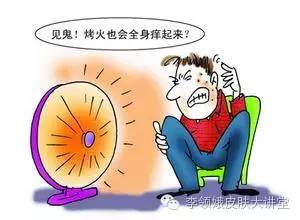 火激性红斑跟烤什么有关,火激红斑为什么会把皮肤烤脱色