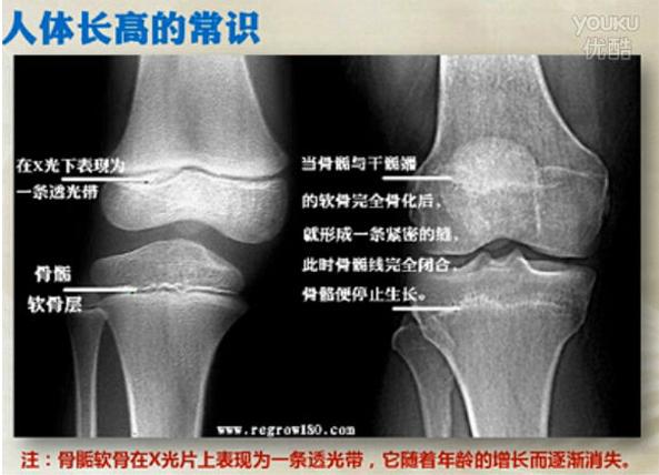 长高的原理及道理,长高生长素是真的吗
