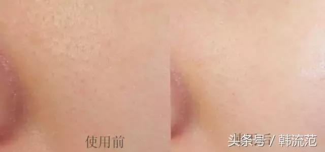 城野医生毛孔收敛水效果怎么样,城野医生毛孔收敛水可以祛闭口吗