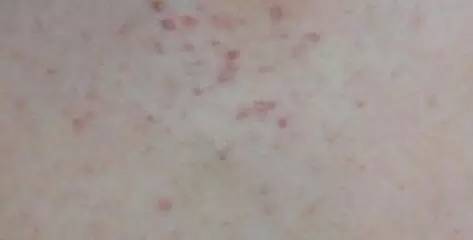 据说大部分的中国人到新加坡之后都有这种“病”!