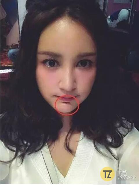 杨幂下颌角手术对比,杨幂下颌角手术对比图文