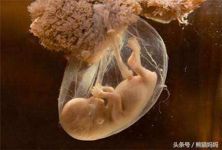 少量破水没有宫缩多久需要去医院,破水不宫缩不见红肚子不痛怎么办