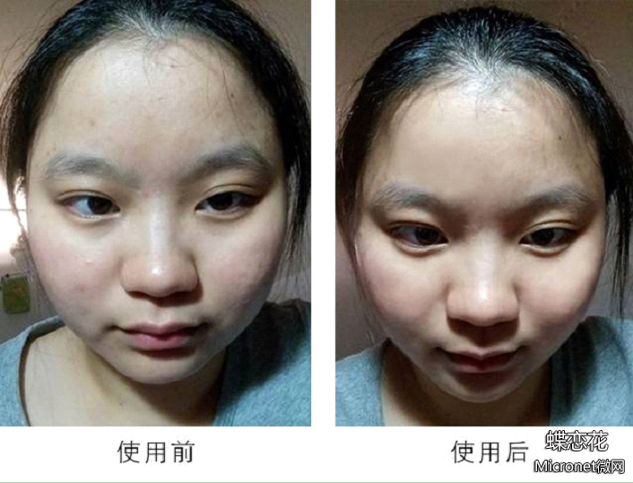 臻宠焕颜补水亮肤蕾丝面膜测评,蕾丝奢华养肤补水保湿面膜怎么用