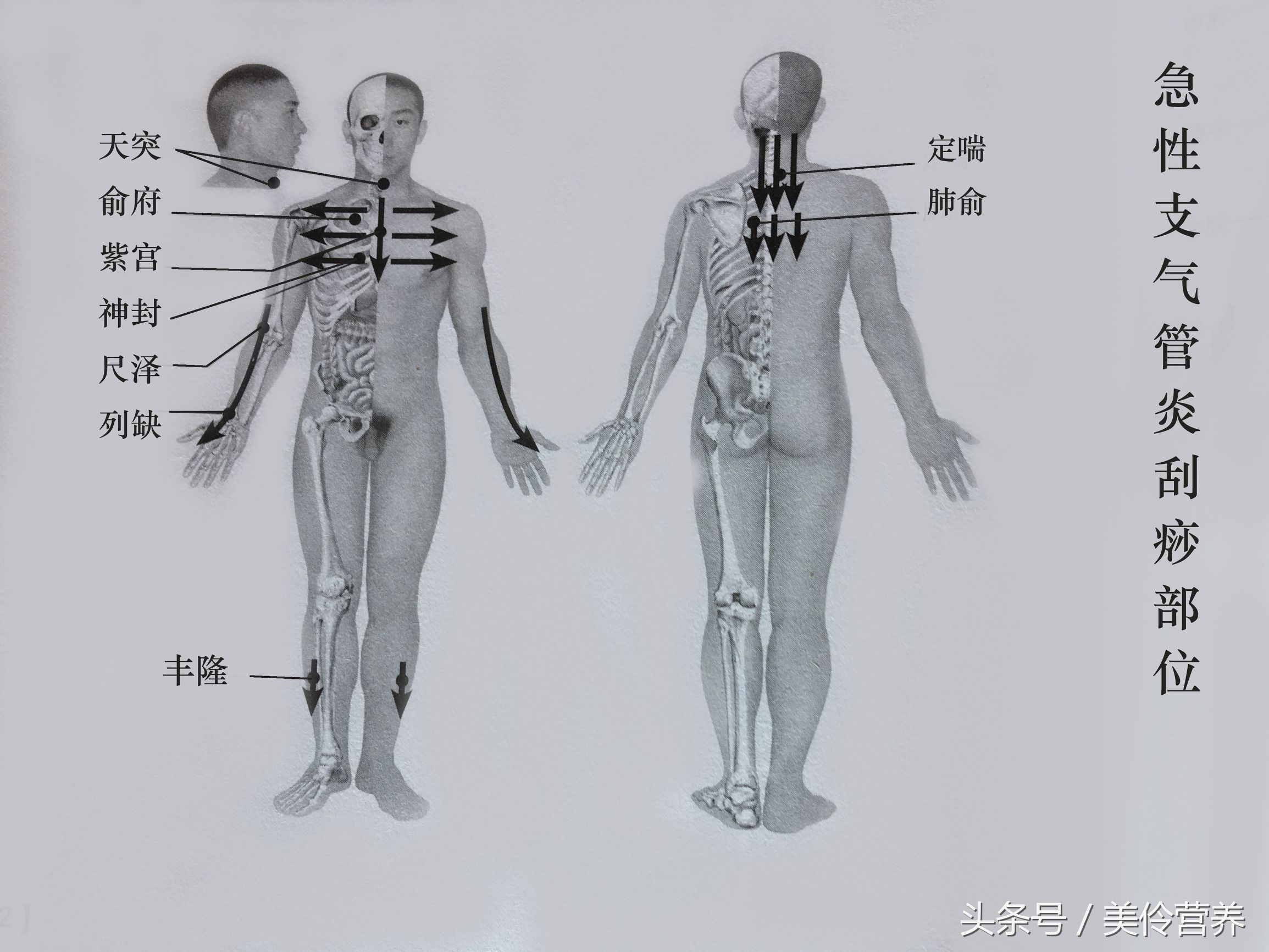 支气管炎穴位刮痧视频,支气管炎咳嗽刮痧哪里效果最快