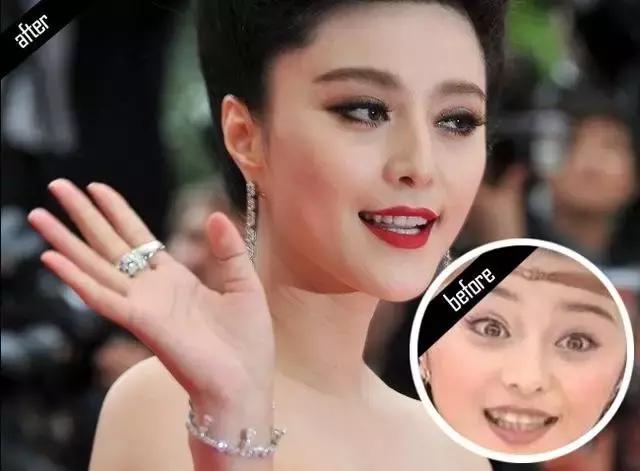 林允的牙怎么又恢复了,林允回应脸型变化她又变脸了吗