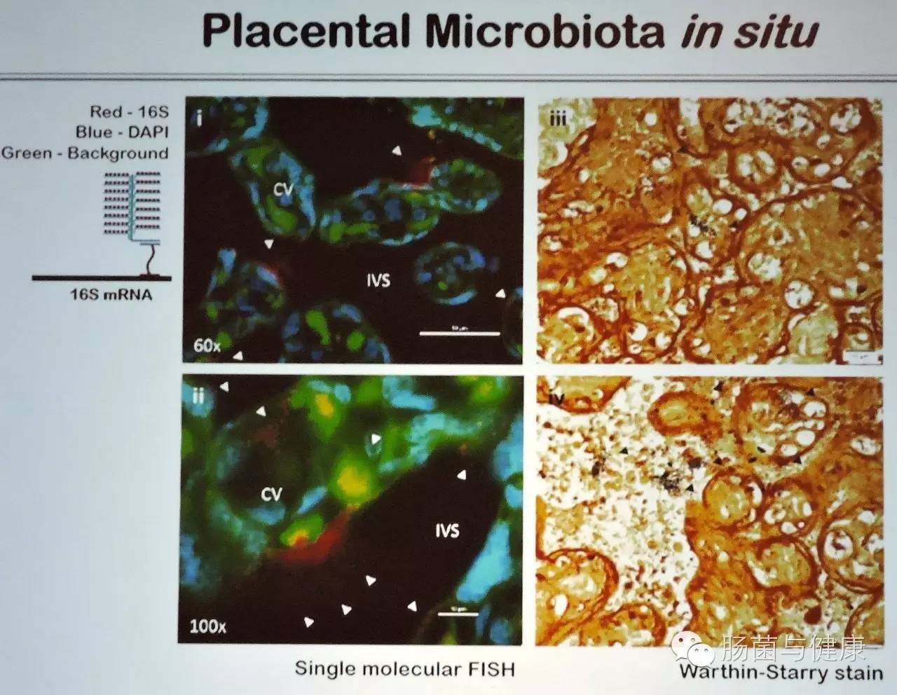 胎盘不存在微生物是什么意思,如何确定胎盘有活性