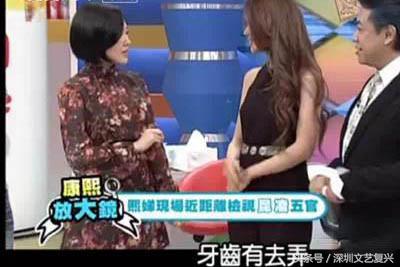 林允整牙效果怎么样,林允整牙后变化图片