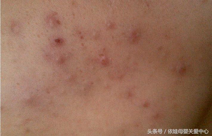 怀孕后皮肤变好变白变光滑,怀孕后气色差面部皮肤发黄