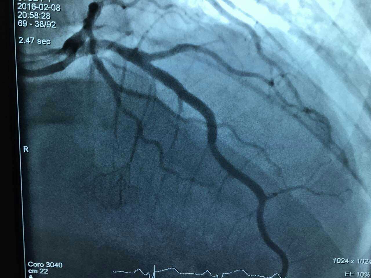 解放军306医院除夕之夜倒计时与正计时