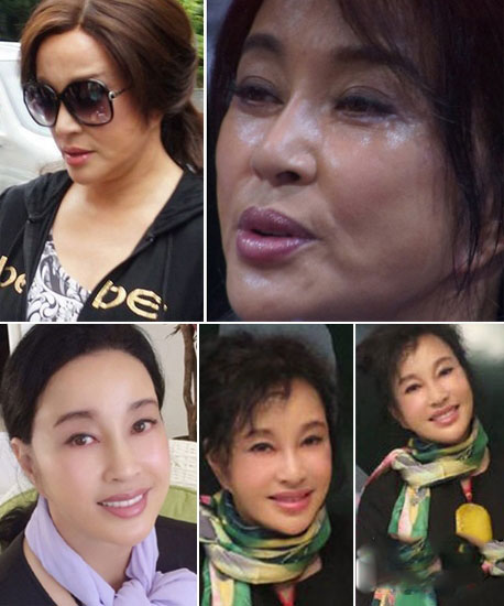 刘晓庆整容前后对比照吓人驻颜有术是骗人的!