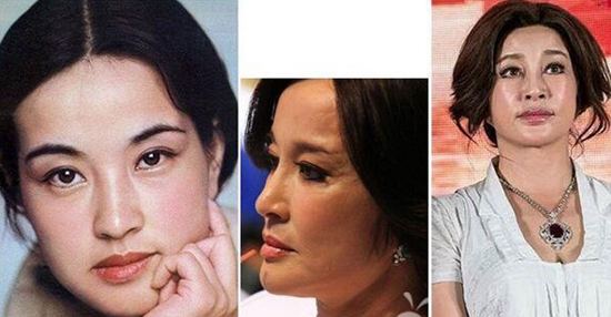 刘晓庆整容前后对比照吓人驻颜有术是骗人的!