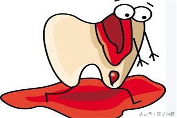 牙龈出血是什么疾病征兆,牙龈出血的原因和治疗方法