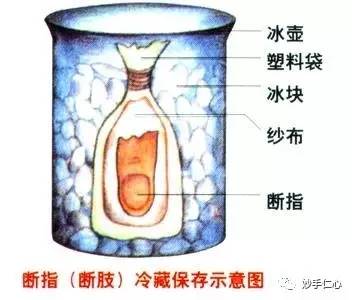 厨房养生小常识大全,厨房急救小常识