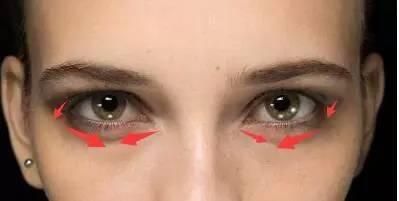 消除黑眼圈和眼袋的最有效的方法,熬夜出来的黑眼圈有什么办法消除