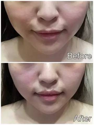 抗老猛药护肤品,抗老猛药a醇你真的会用吗