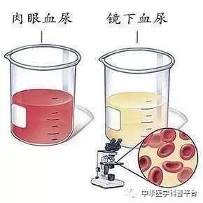 看尿液颜色判断身体有多少水,通过尿液颜色也能辨健康