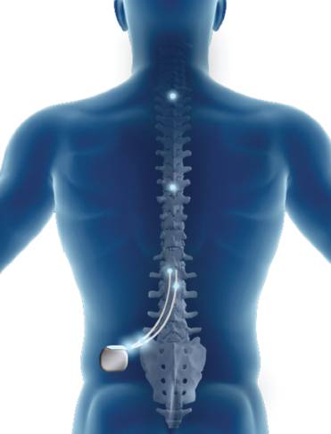 疼痛机制大揭秘,痛感检测