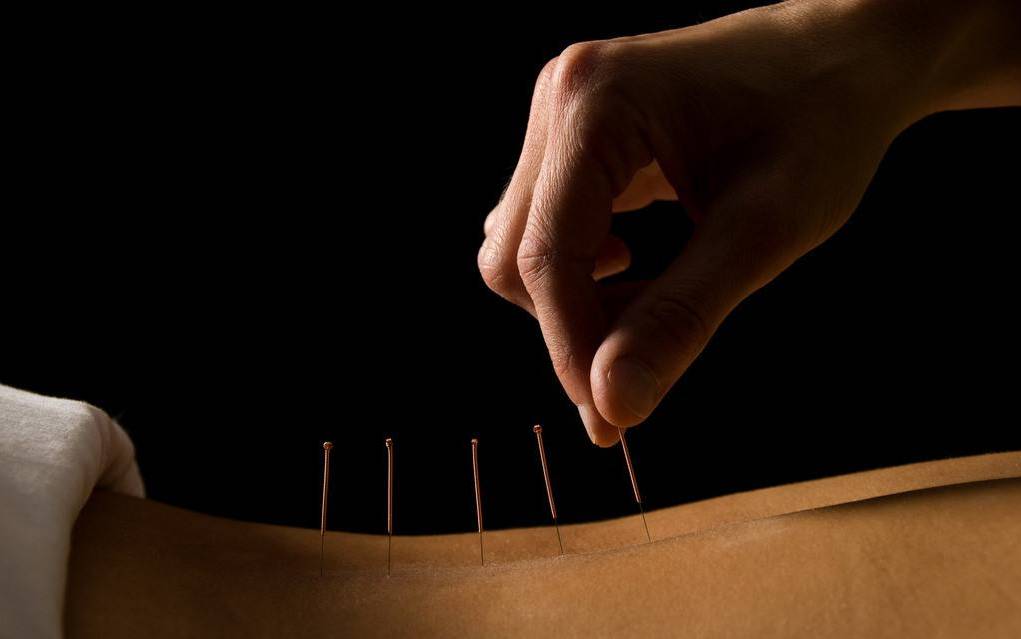 微针注入生长因子,微针生发治疗