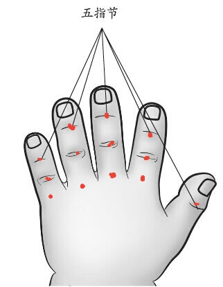 吴老师推荐:上午孩子从床上摔下来,下午就发烧