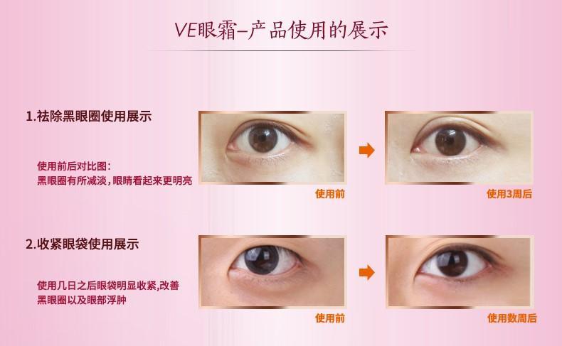 眼部问题严重用哪个眼霜合适,眼部护理涂眼霜的作用