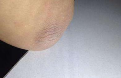 快速缓解皮肤干燥的小妙招,女生皮肤干燥怎么办最快最好