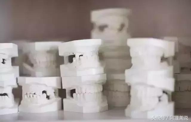 矫正前一定要做口扫吗,矫正前必须拍ct吗