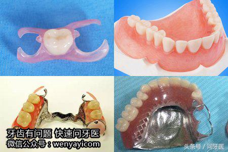 少颗牙齿怎么快速解决,少了一颗大牙怎么办
