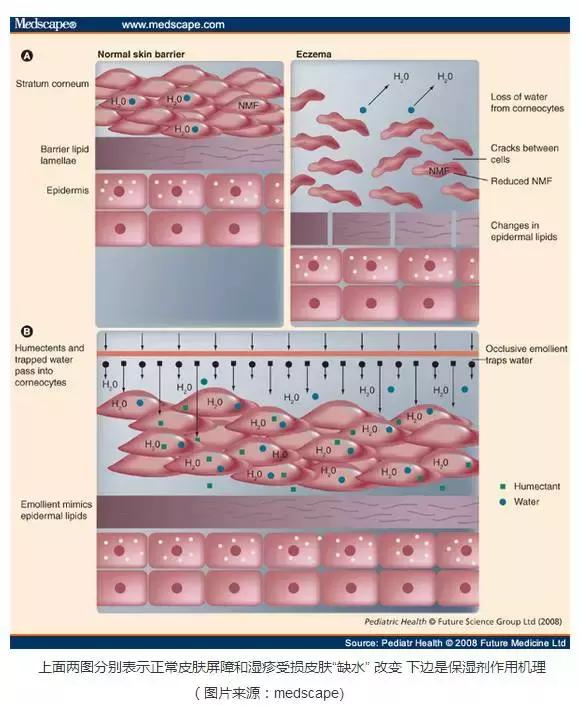 肤乐霜治疗湿疹有效吗,湿疹用肤乐霜和什么一起用